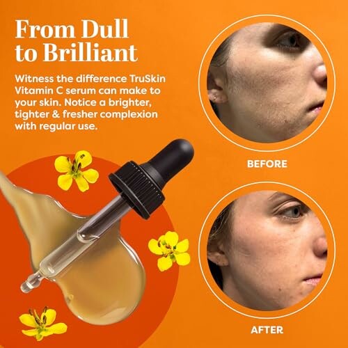 TruSkin Vitamin C serum before and after comparison with dropper and flowers.